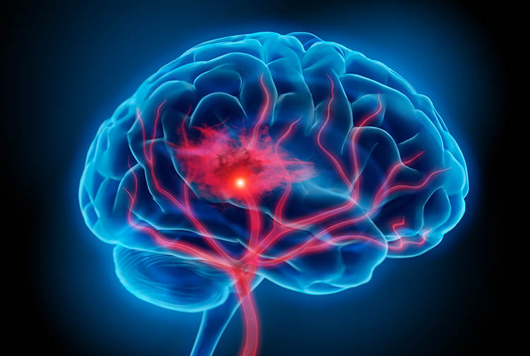 illustration of a blue brain with red vessels on a black background