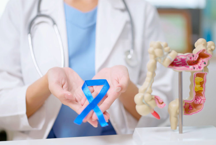 Doctor holds blue ribbon symbolizing colorectal cancer awareness next to a model of the colon.