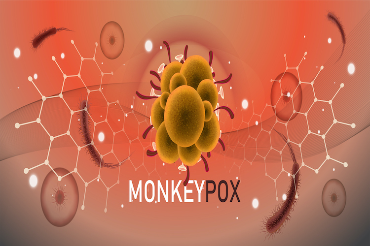 A composite image of the monkeypox virus