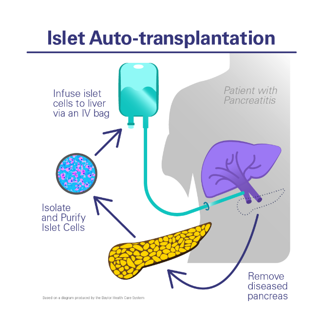 Diagram showing Islet Auto-transplantation