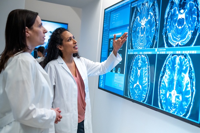 Healthcare providers looking at brain scans.
