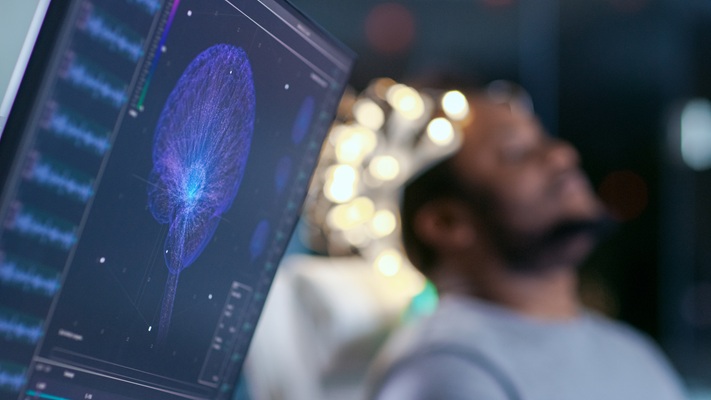 A patient being tested for electrical activity in the brain.