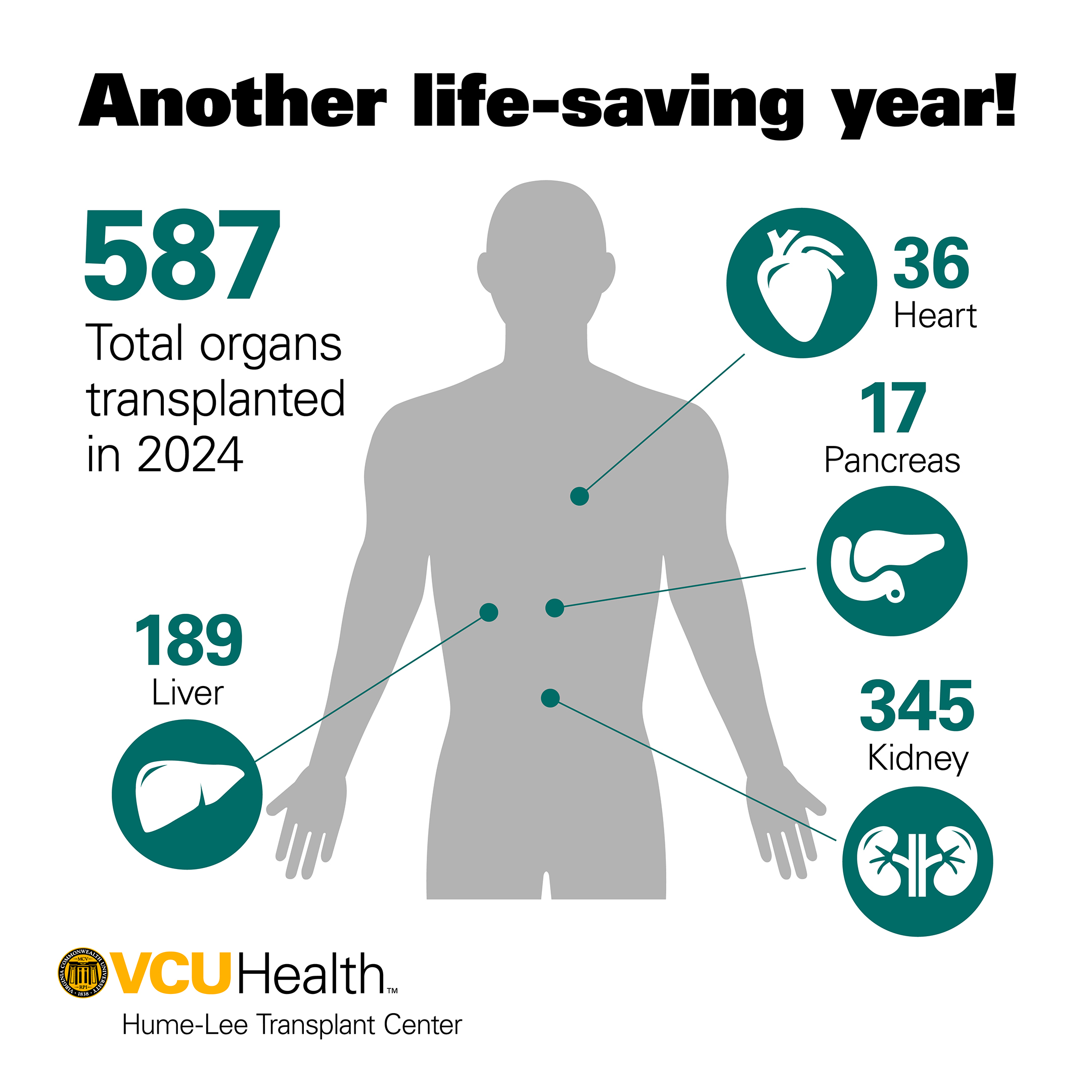 Graphic showing total number of transplants in 2024