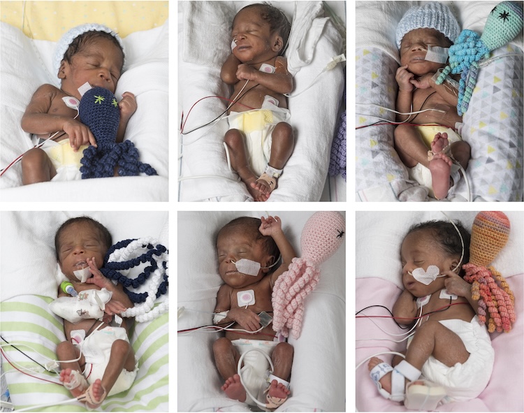 Collage of six premature babies the NICU.