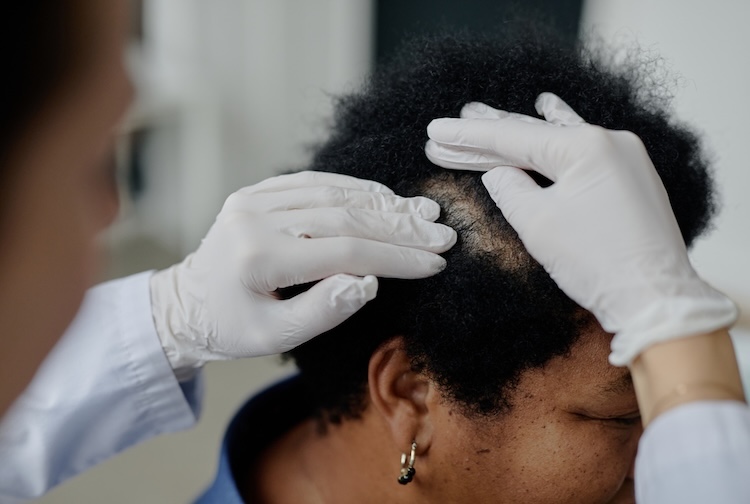 A middle-aged Black woman undergoes a scalp examination by a dermatologist