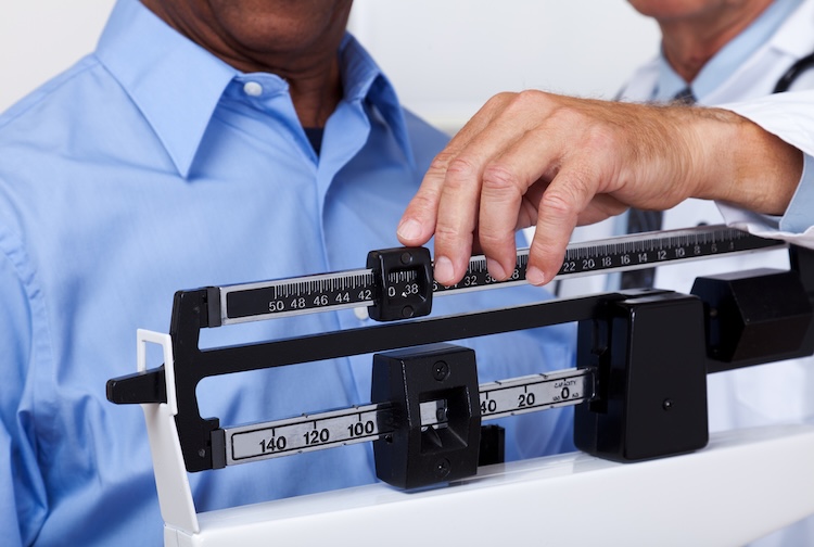 Doctor checks the weight of a man on a scale