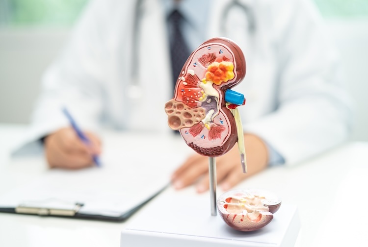 doctor filling out paperwork at desk next to a model of a kidney.