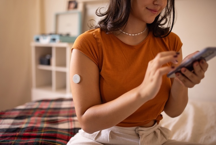 Young woman sitting on her bed and using smart phone at home, she has a glucose monitor on her arm.
