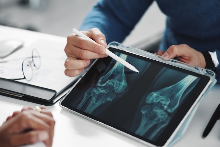 Doctor, patient and hands on tablet screen for knee x ray with injury.