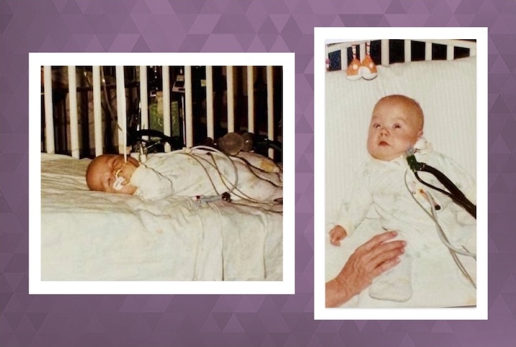 Ty as a small baby with breathing tubes under his nose.