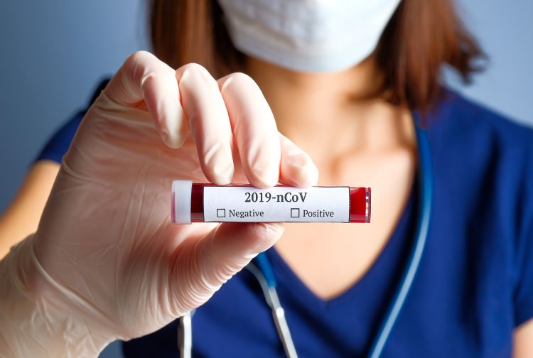 Coronavirus Testtube