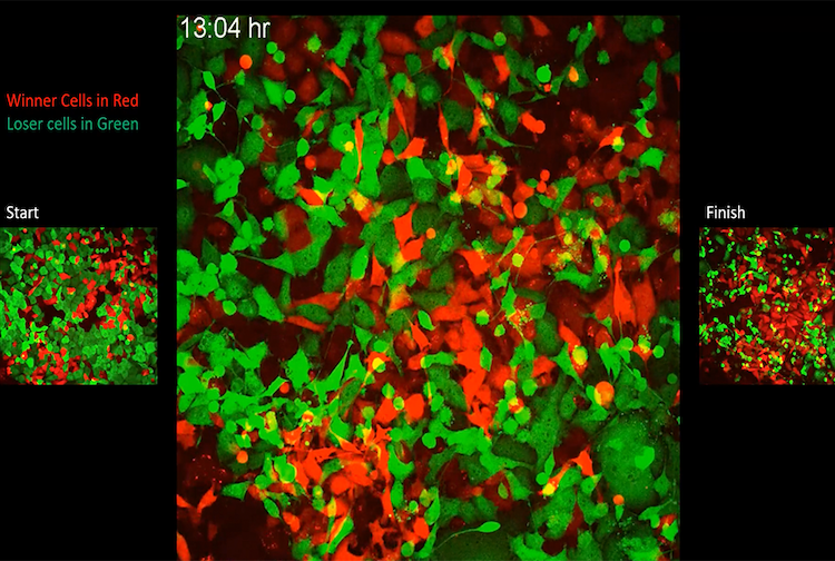 Cancer Cells using code 