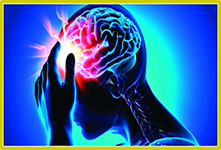 image of head pain, alluding to stroke