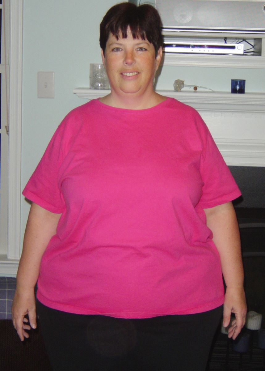 Mary DeCosta before surgery