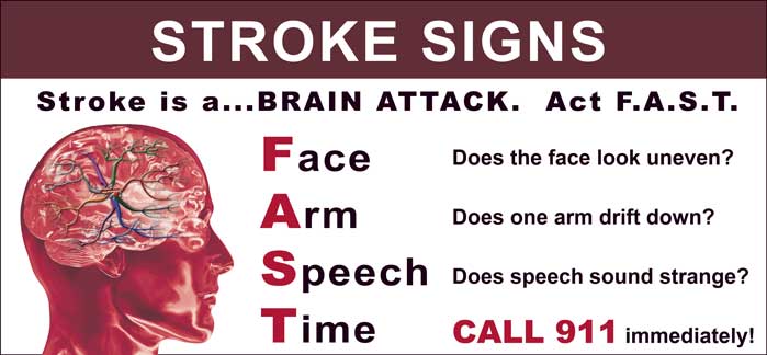 A graphic explaining signs of a stroke.